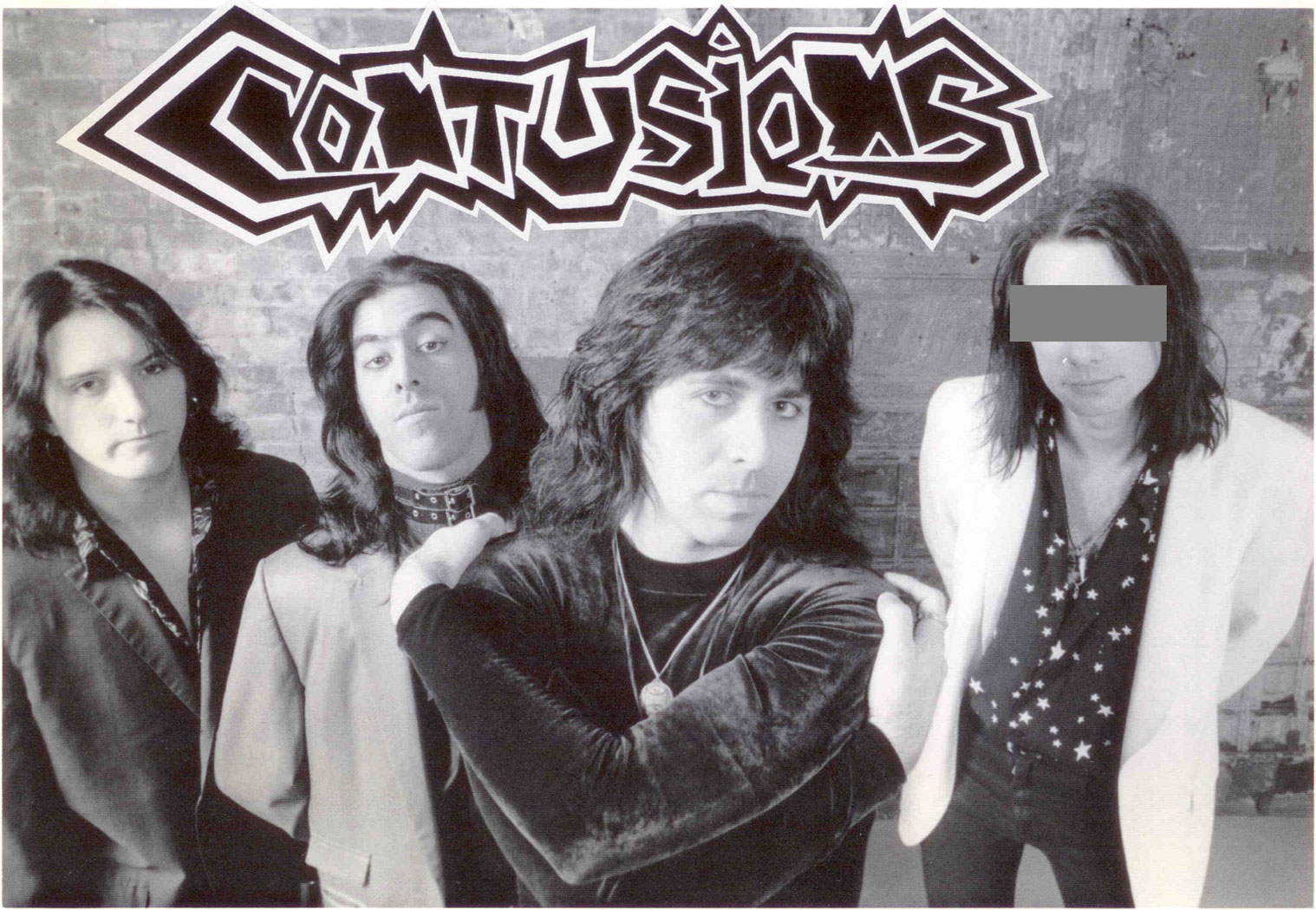 contusions